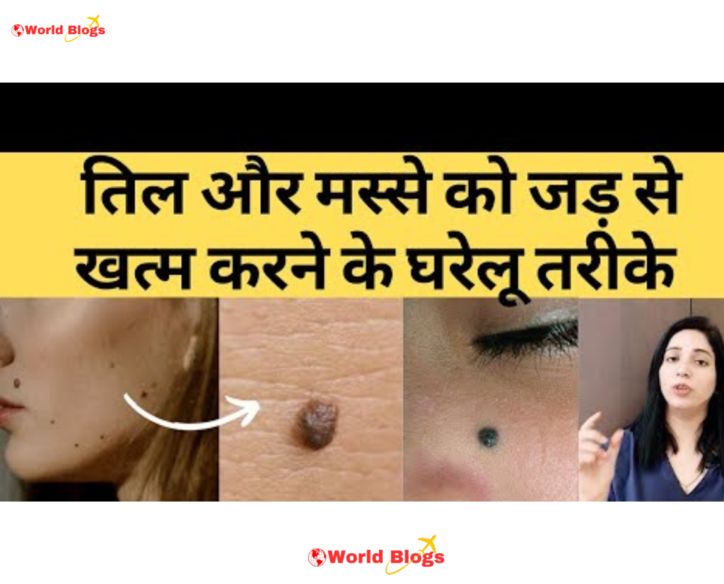 Moles and warts on the body